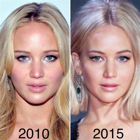 jennifer lawrence nose job.